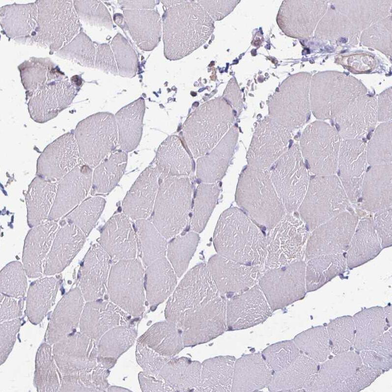 Staining of human skeletal muscle shows no positivity in myocytes.