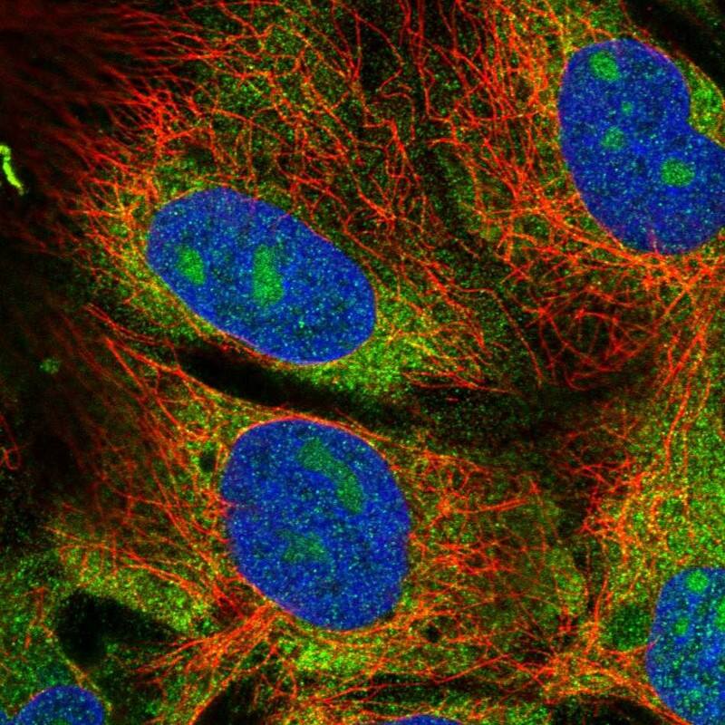 Staining of human cell line CACO-2 shows positivity in nucleoli & cytoplasm.