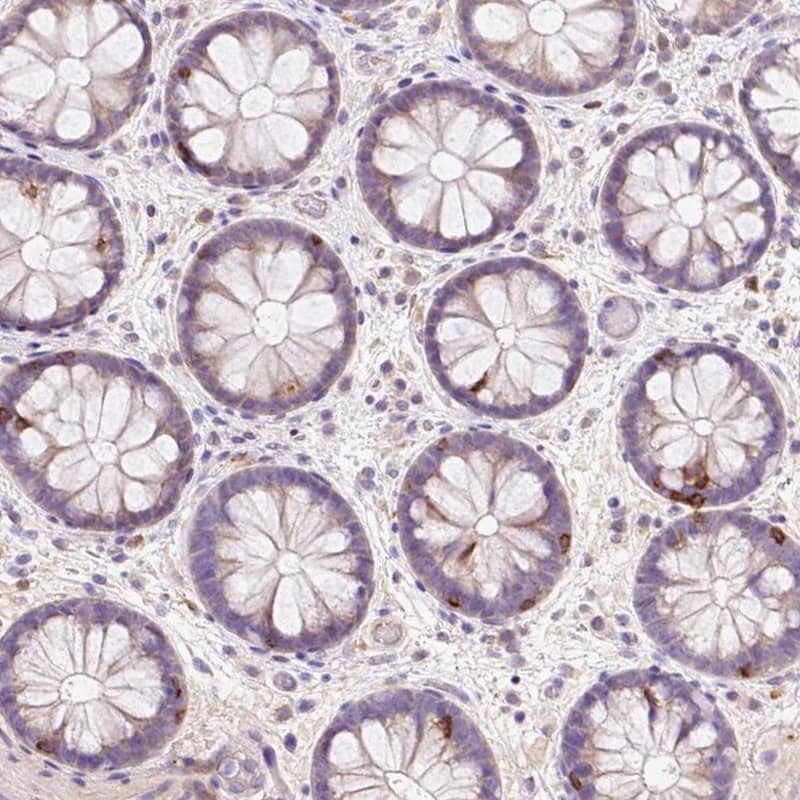 Staining of human colon shows moderate to strong cytoplasmic positivity in lymphoid cells.
