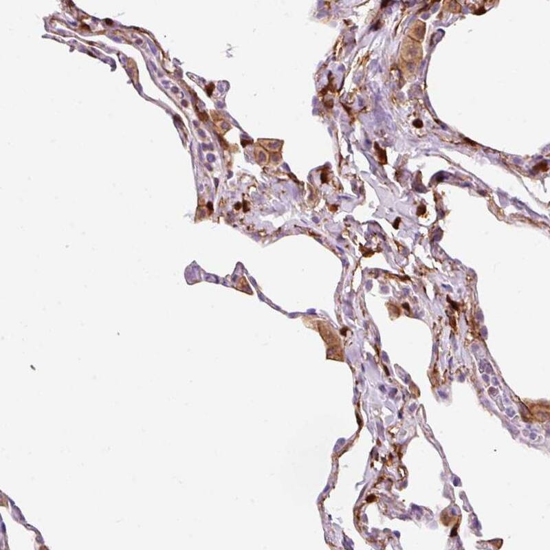 Staining of human lung shows moderate membranous and cytoplasmic positivity in macrophages.