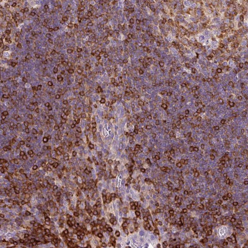 Staining of human tonsil shows moderate to strong cytoplasmic positivity in lymphoid cells.