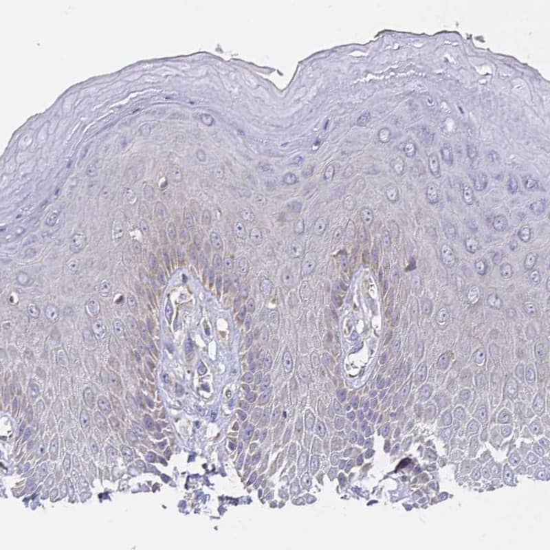 Staining of human skin shows negative to very weak cytoplasmic granular positivity in squamous epithelial cells as expected.