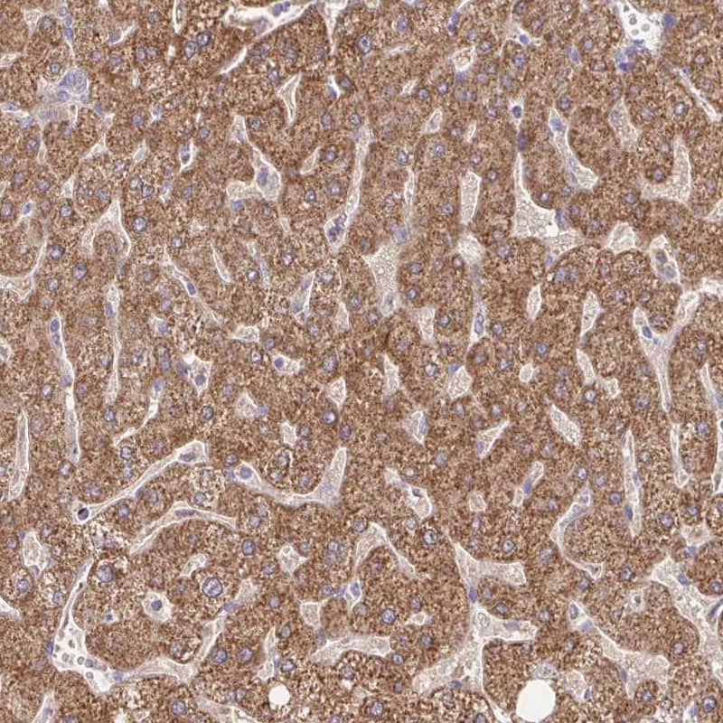 Staining of human liver shows strong cytoplasmic granular positivity in hepatocytes.