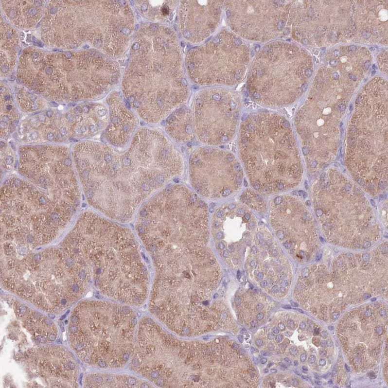 Immunohistochemistry-Paraffin TYW1 Antibody