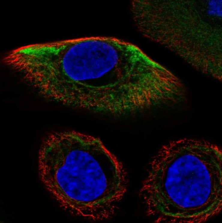  Staining of human cell line hTCEpi shows localization to intermediate filaments.