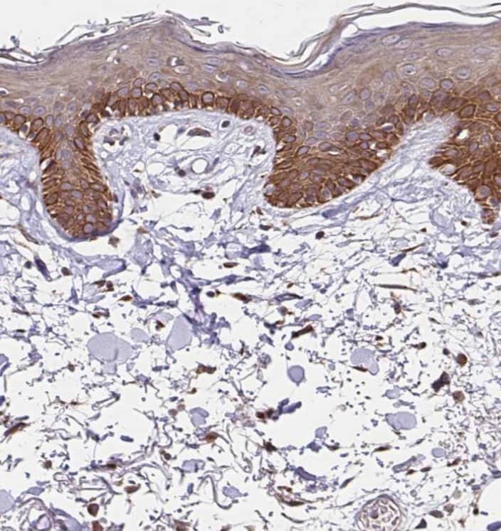 Immunohistochemistry-Paraffin ZW10 Antibody - BSA Free