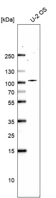 Westen Blot ZW10 Antibody - BSA Free