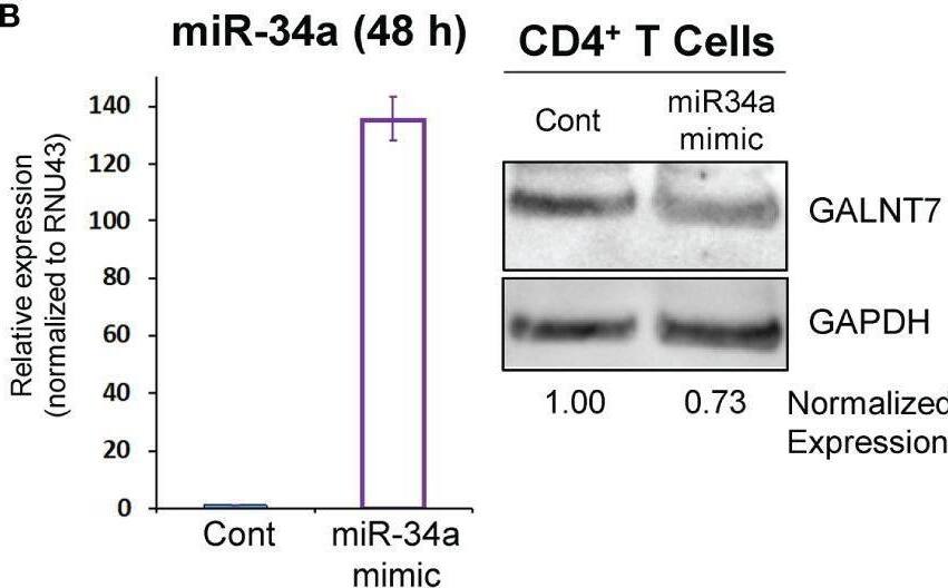 miR-34a regulates GALNT7 expression in primary T Cells. (A) Optimization of miR-34a used in nucleofection. miR-34a was overexpressed in mouse CD4+ T cells (B) or EL4 cells (C). miR-34a mRNA levels were assessed using qPCR. GALNT7 levels were measured using western blotting. Data from representative experiments are shown. Image collected and cropped by CiteAb from the following open publication (//pubmed.ncbi.nlm.nih.gov/35087510), licensed under a CC-BY license. Not internally tested by Novus Biologicals.