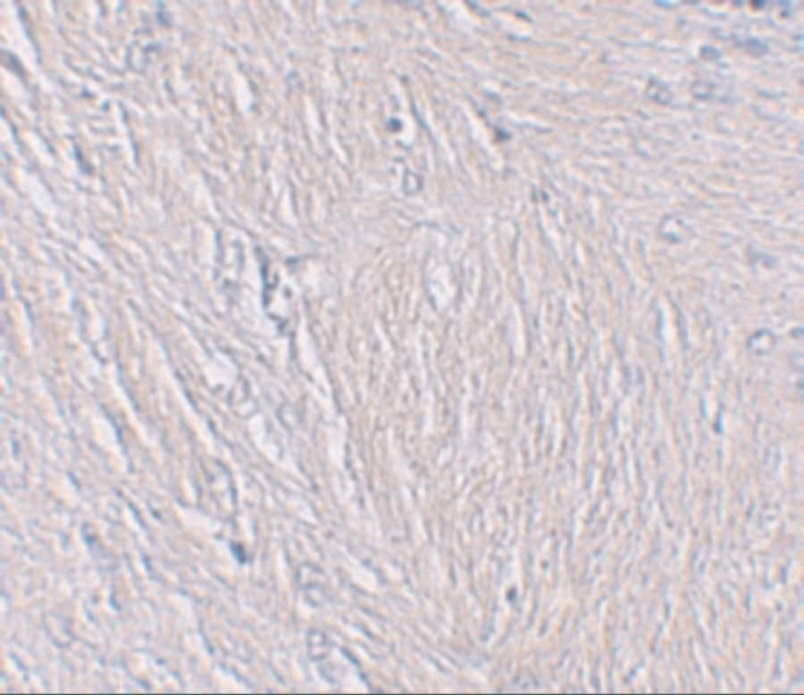 Immunohistochemistry: Synaptopodin Antibody - BSA Free [NBP2-39100] - Immunohistochemistry of Synaptopodin in human brain tissue with Synaptopodin antibody at 2.5 u/mL.