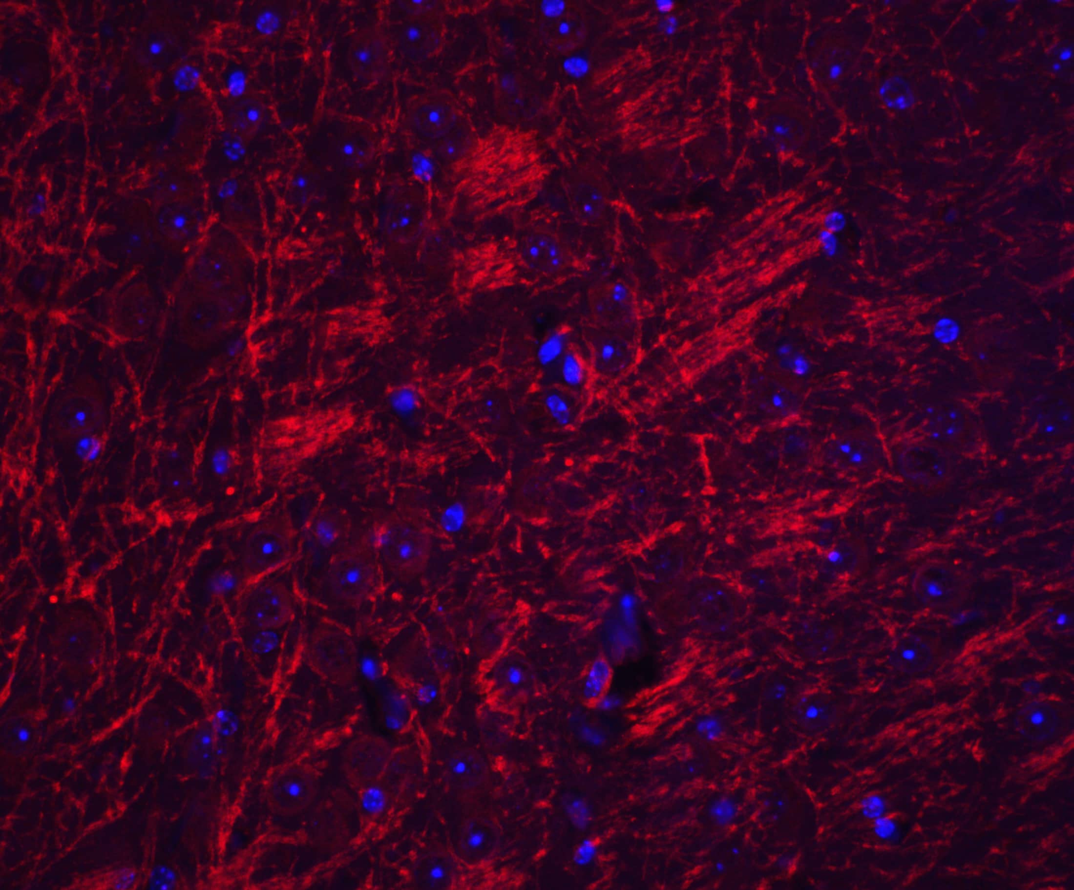 Immunocytochemistry/ Immunofluorescence: Synaptopodin Antibody - BSA Free [NBP2-39100] - Immunofluorescence of Synaptopodin in mouse brain tissue with Synaptopodin antibody at 20 u/mL.Red: Synaptopodin Antibody   Blue: DAPI staining