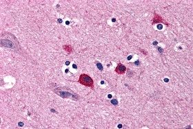 Immunohistochemistry: BOK Antibody - BSA Free [NBP2-41045] - Immunohistochemistry of BOK in human brain tissue with BOK antibody at 5 ug/mL.