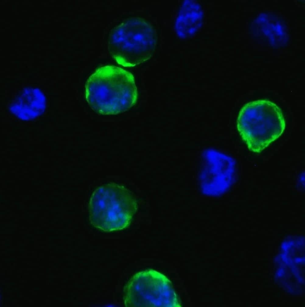 Immunocytochemistry/ Immunofluorescence: SARS-CoV-2 Spike Antibody - BSA Free [NBP2-41058] - Validation of SARS-CoV-2 (COVID-19) Spike in 293T Cells. Immunofluorescent analysis of 4% paraformaldehyde-fixed 293T cells labeling SARS-CoV-2 (COVID-19) Spike with  at 1 ug/mL, followed by goat anti-rabbit IgG secondary antibody at 1/500 dilution (green) and DAPI staining (blue). 