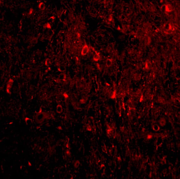 Immunocytochemistry/ Immunofluorescence: Nogo-A Antibody - BSA Free [NBP2-41070] - Immunofluorescence of Nogo-A in Mouse Brain cells with Nogo-A antibody at 20 ug/mL.