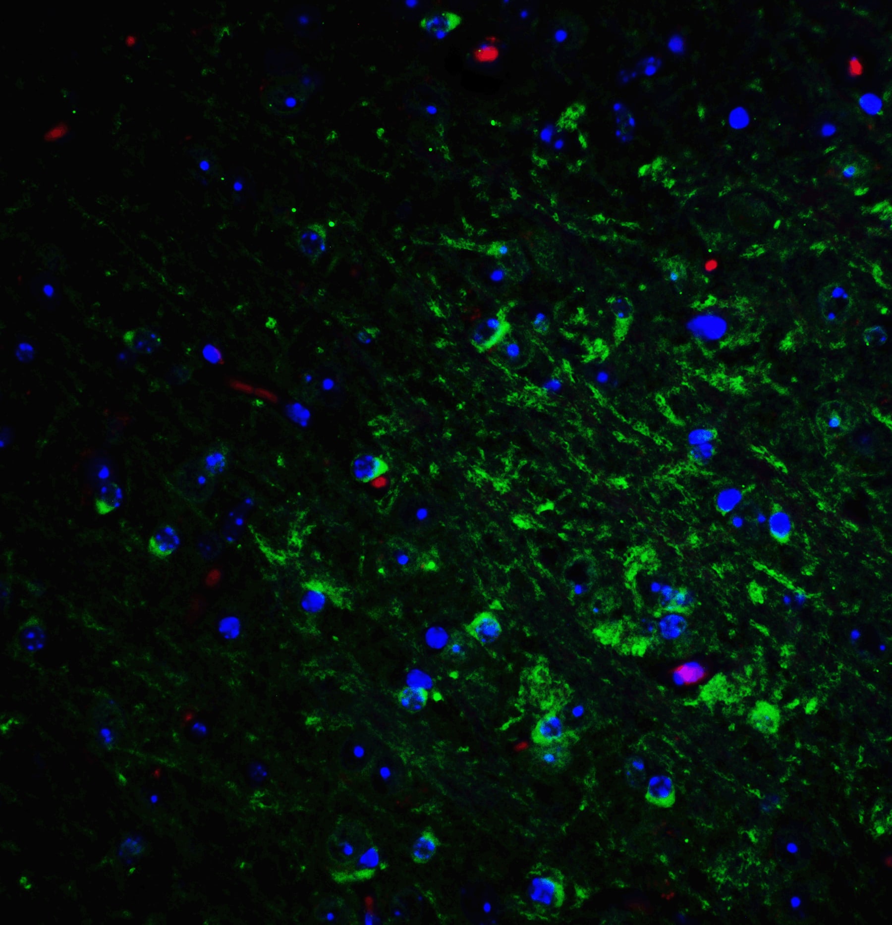 Immunocytochemistry/ Immunofluorescence: Nogo-A Antibody - BSA Free [NBP2-41071] - Immunofluorescence of Nogo-A in mouse brain tissue with Nogo-A Antibody at 20 u/mL.Green: Nogo-A antibody   Red: Phylloidin staining Blue: DAPI staining