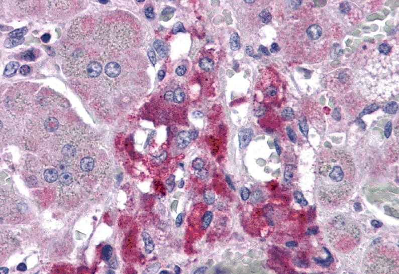Immunohistochemistry: RIMS2 Antibody - BSA Free [NBP2-41077] - Immunohistochemistry of RIMS2 in human adrenal gland tissue with RIMS2 antibody at 5 ug/mL.