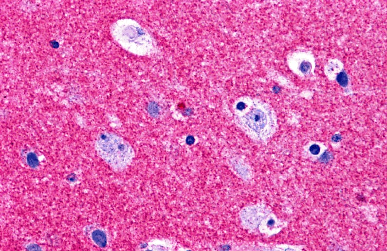 Immunohistochemistry: RIMS2 Antibody - BSA Free [NBP2-41078] - Immunohistochemistry of RIMS2 in human brain tissue with RIMS2 antibody at 5 ug/ml