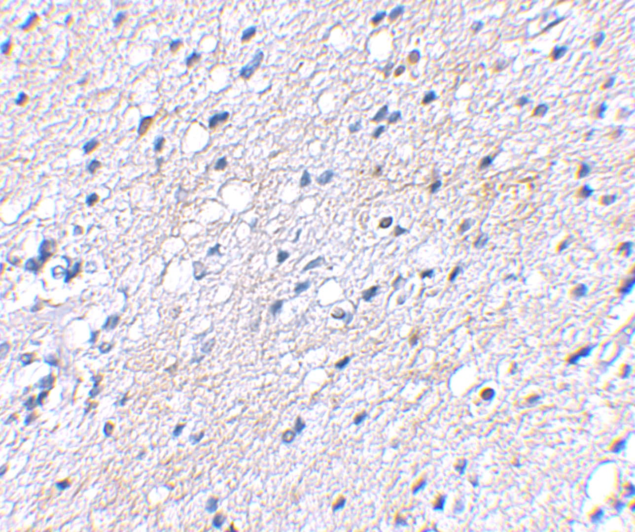 Immunohistochemistry BAIAP3 Antibody - BSA Free