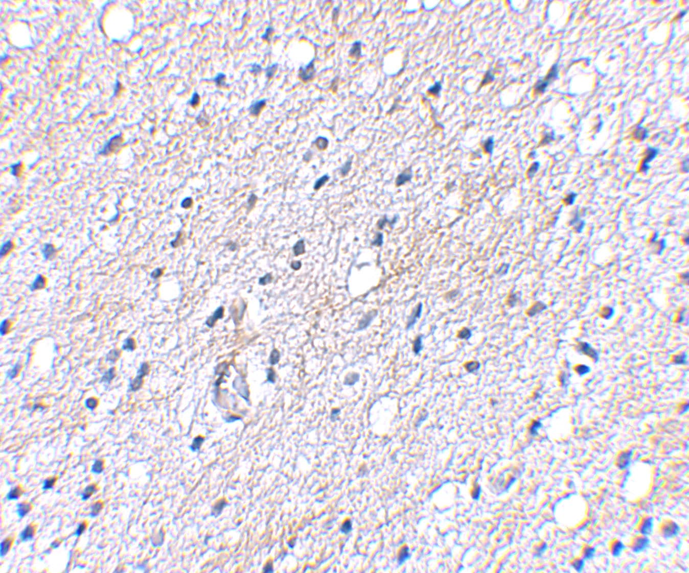Immunohistochemistry: BAIAP3 Antibody - BSA Free [NBP2-41080] - Immunohistochemical staining of human brain tissue using BAIAP3 antibody at 5 ug/mL.