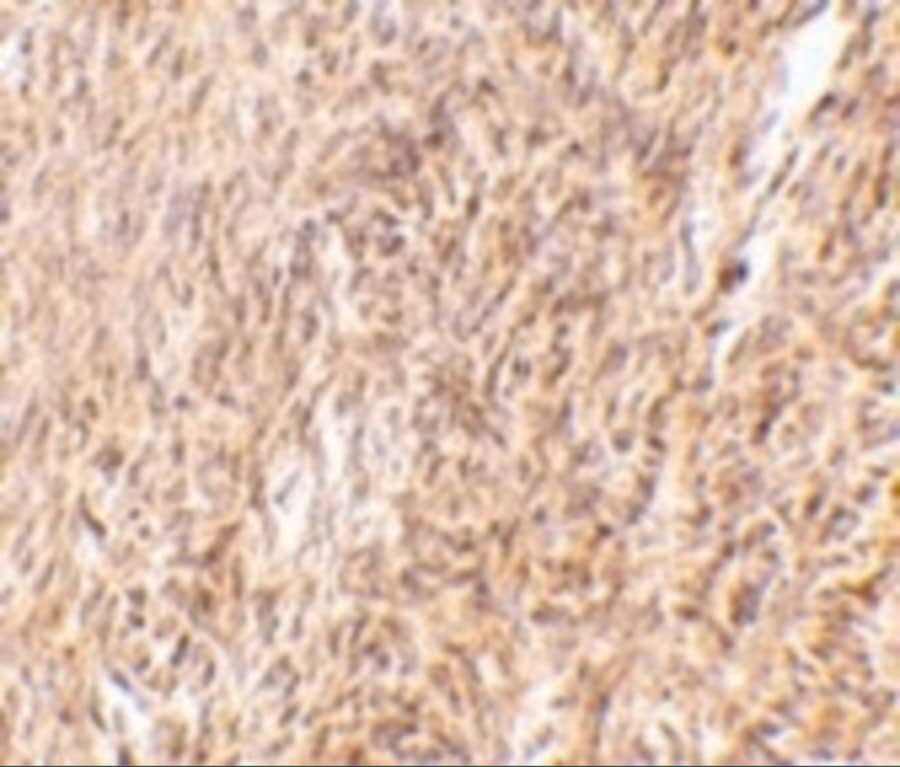 Immunohistochemistry: TRIM30 Antibody - BSA Free [NBP2-41087] - Immunohistochemistry of TRIM30 in mouse ovary tissue with TRIM30 antibody at 10 u/mL.