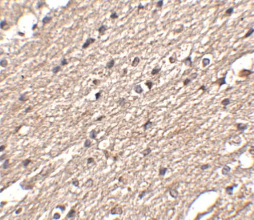 Immunohistochemistry SPRED3 Antibody - BSA Free