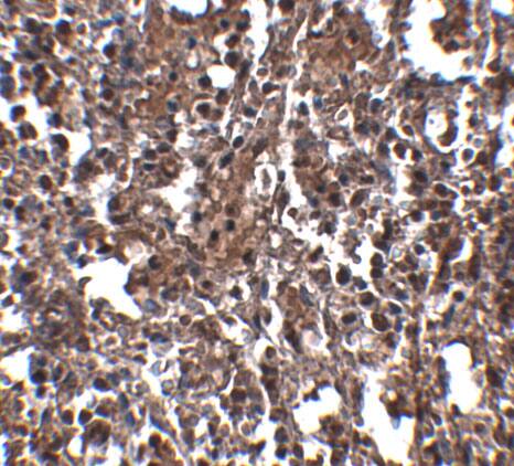 Immunohistochemistry: Klra2 Antibody - BSA Free [NBP2-41096] - Immunohistochemistry of Klra2 in mouse spleen tissue with Klra2 antibody at 2.5 ug/mL.