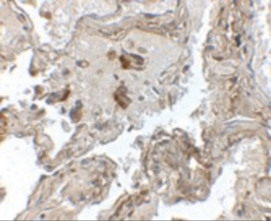 Immunohistochemistry: Transthyretin/Prealbumin Antibody - BSA Free [NBP2-41101] - Immunohistochemistry of Transthyretin/Prealbumin in human lung tissue with Transthyretin/Prealbumin antibody at 2.5 ug/mL.