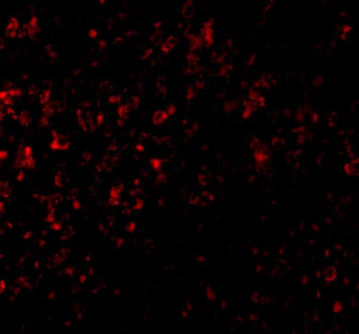 Immunocytochemistry/ Immunofluorescence: GPR3 Antibody - BSA Free [NBP2-41102] - Immunofluorescence of GPR3 in Human Spleen cells with GPR3 antibody at 20 ug/mL.
