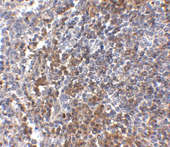 Immunohistochemistry: GPR3 Antibody - BSA Free [NBP2-41102] - Immunohistochemistry of GPR3 in human spleen tissue with GPR3 antibody at 2.5 u/mL.
