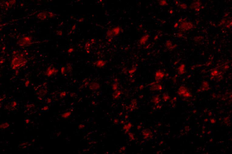 Immunocytochemistry/ Immunofluorescence Melanocortin-4 R Antibody - BSA Free