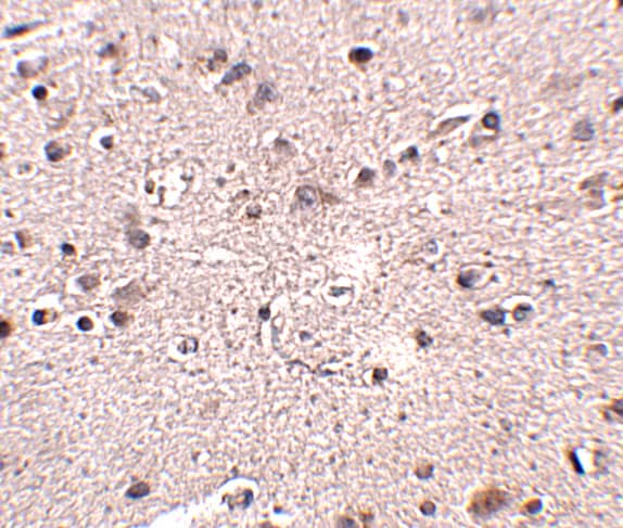 Immunohistochemistry: Melanocortin-4 R Antibody - BSA Free [NBP2-41103] - Immunohistochemistry of Melanocortin-4 R in human brain tissue with Melanocortin-4 R antibody at 2.5 u/mL.