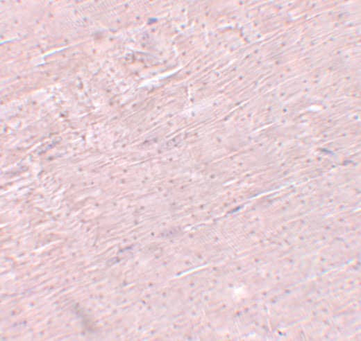 Immunohistochemistry: ADAMTSL5 Antibody - BSA Free [NBP2-41120] - Immunohistochemistry of ADAMTSL5 in mouse skeletal muscle tissue with ADAMTSL5 antibody at 5 ug/mL.