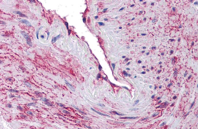 Immunohistochemistry: SCUBE3 Antibody - BSA Free [NBP2-41122] - Immunohistochemistry of SCUBE3 in human blood vessel tissue with SCUBE3 antibody at 10 ug/mL.