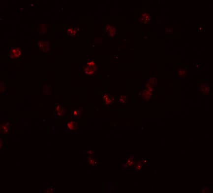 Immunocytochemistry/ Immunofluorescence: NLRC3 Antibody - BSA Free [NBP2-41123] - Immunofluorescence of NLRC3 in Jurkat cells with NLRC3 antibody at 20 u/mL.