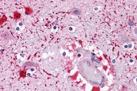 Immunohistochemistry: PIWIL2 Antibody - BSA Free [NBP2-41126] - Immunohistochemistry of PIWIL2 in human brain tissue with PIWIL2 antibody at 5 ug/mL.