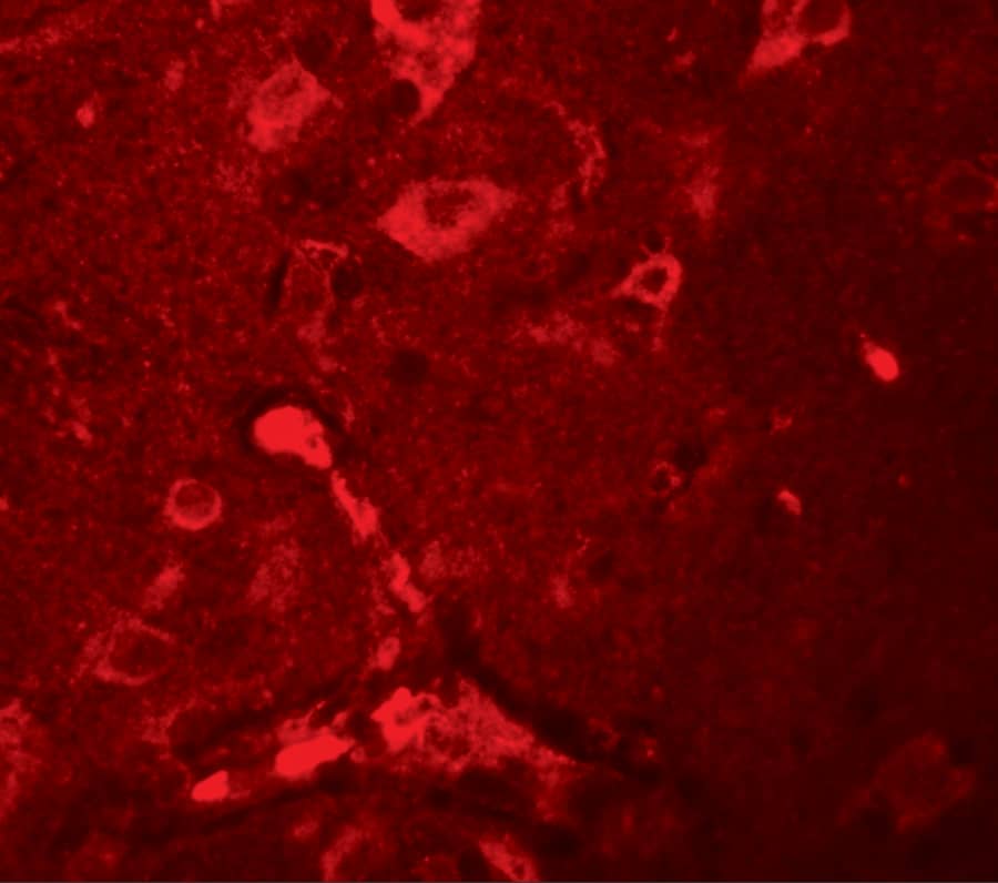 Immunocytochemistry/ Immunofluorescence APBA2 Antibody - BSA Free