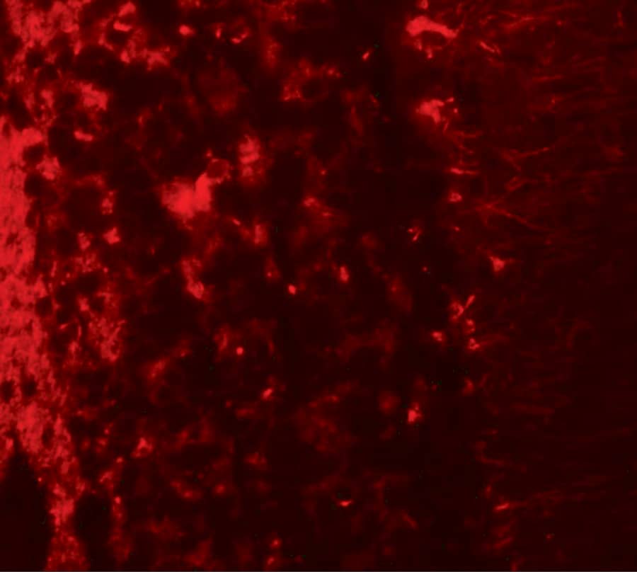 Immunocytochemistry/ Immunofluorescence: LRRTM2 Antibody - BSA Free [NBP2-41129] - Immunofluorescence of LRRTM2 in human brain tissue with LRRTM2 antibody at 20 ug/mL.