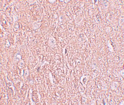Immunohistochemistry: LRRTM2 Antibody - BSA Free [NBP2-41129] - Immunohistochemistry of LRRTM2 in human brain tissue with LRRTM2 antibody at 2.5 u/mL.