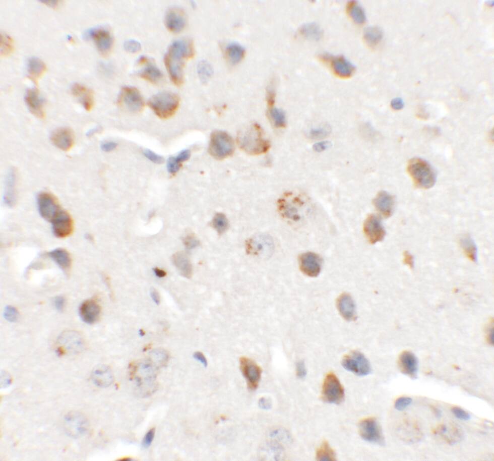 Immunohistochemistry: CHD7 Antibody - BSA Free [NBP2-41133] - Immunohistochemistry of CHD7 in mouse brain tissue with CHD7 antibody at 5 u/mL.