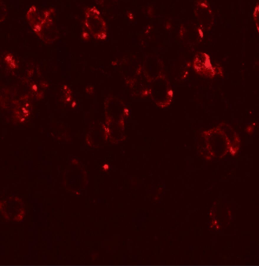 Immunocytochemistry/ Immunofluorescence: CHD7 Antibody - BSA Free [NBP2-41133] - Immunofluorescence of CHD7 in mouse brain tissue with CHD7 antibody at 20 u/mL.