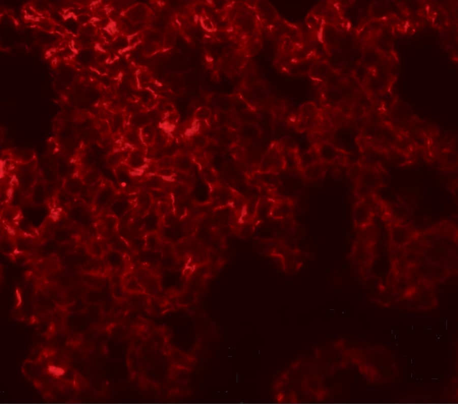 Immunocytochemistry/ Immunofluorescence NETO1 Antibody - BSA Free