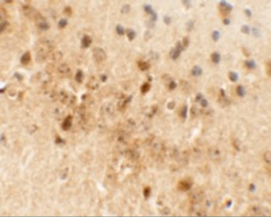 Immunohistochemistry: Draxin/C1orf187 Antibody - BSA Free [NBP2-41135] - Immunohistochemistry of Draxin/C1orf187 in mouse brain tissue with Draxin/C1orf187 antibody at 5 u/mL.