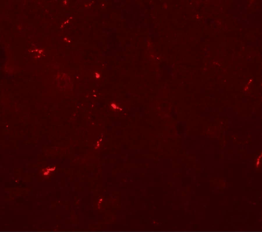 Immunocytochemistry/ Immunofluorescence: Draxin/C1orf187 Antibody - BSA Free [NBP2-41135] - Immunofluorescence of Draxin/C1orf187 in mouse brain tissue with Draxin/C1orf187 antibody at 20 ug/mL.