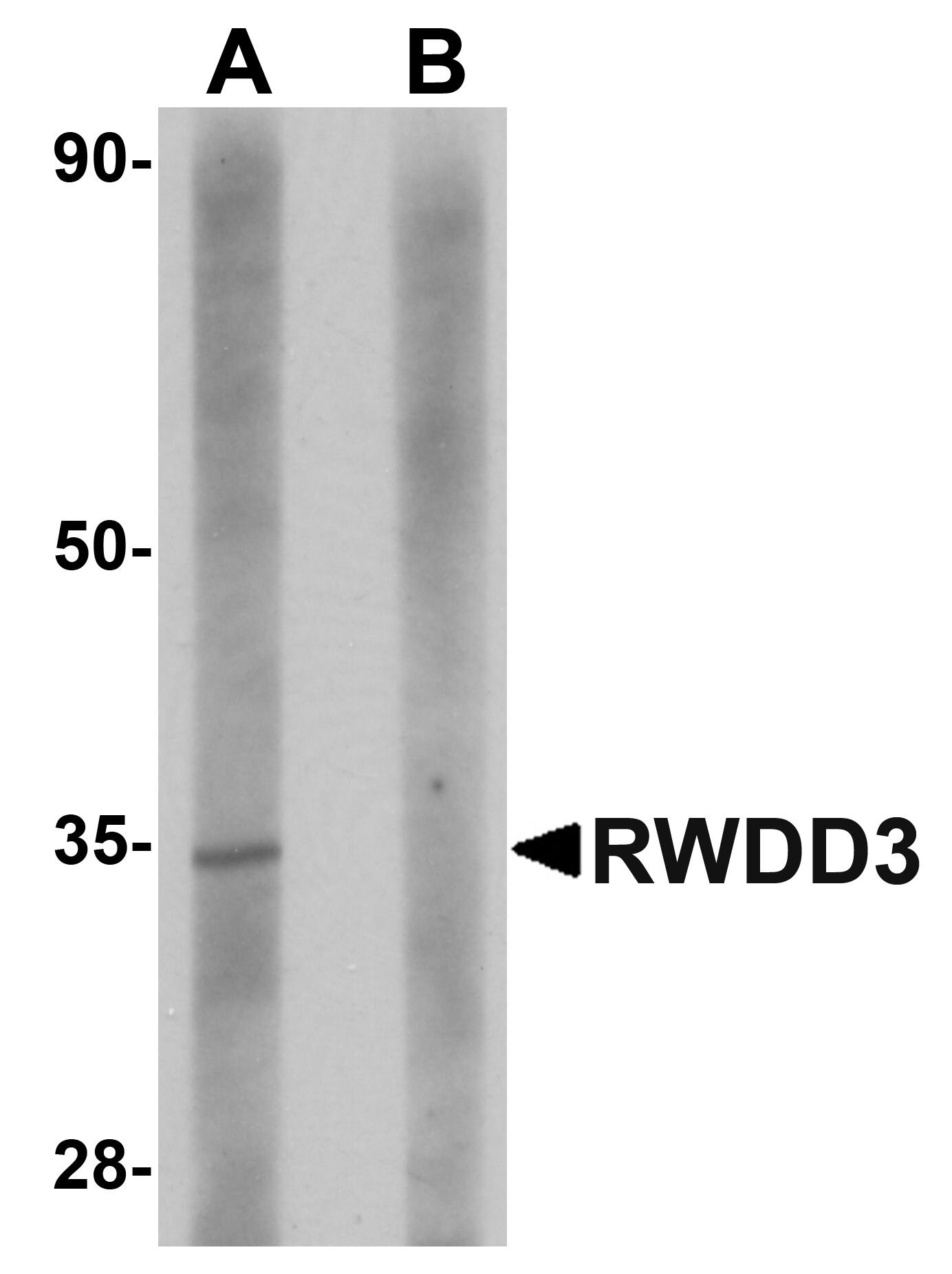 Western Blot: RWDD3 Antibody - BSA Free [NBP1-76310] - Western blot analysis of RWDD3 in rat kidney tissue lysate with RWDD3 antibody at 1 u/mL in (A) the absence and (B) the presence of blocking peptide. 