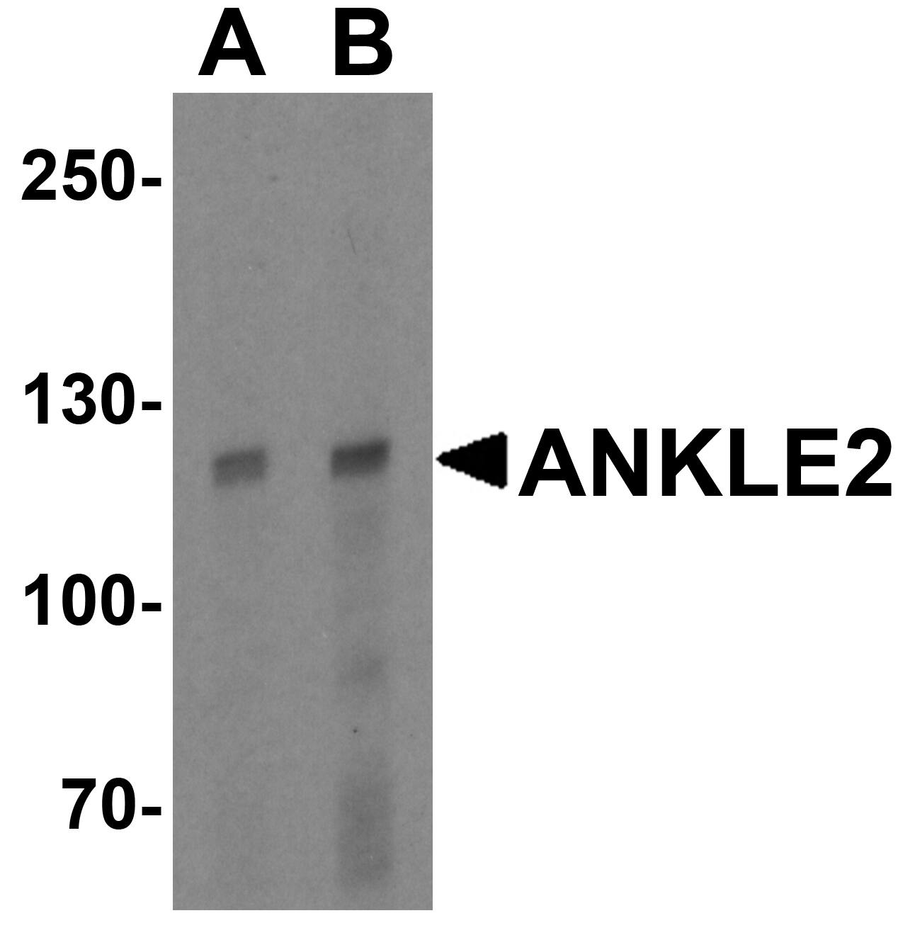 Western Blot: ANKLE2 Antibody - BSA Free [NBP2-41145] - Western blot analysis of ANKLE2 in human testis tissue lysate with ANKLE2 antibody at (A) 1 and (B) 2 ug/mL.