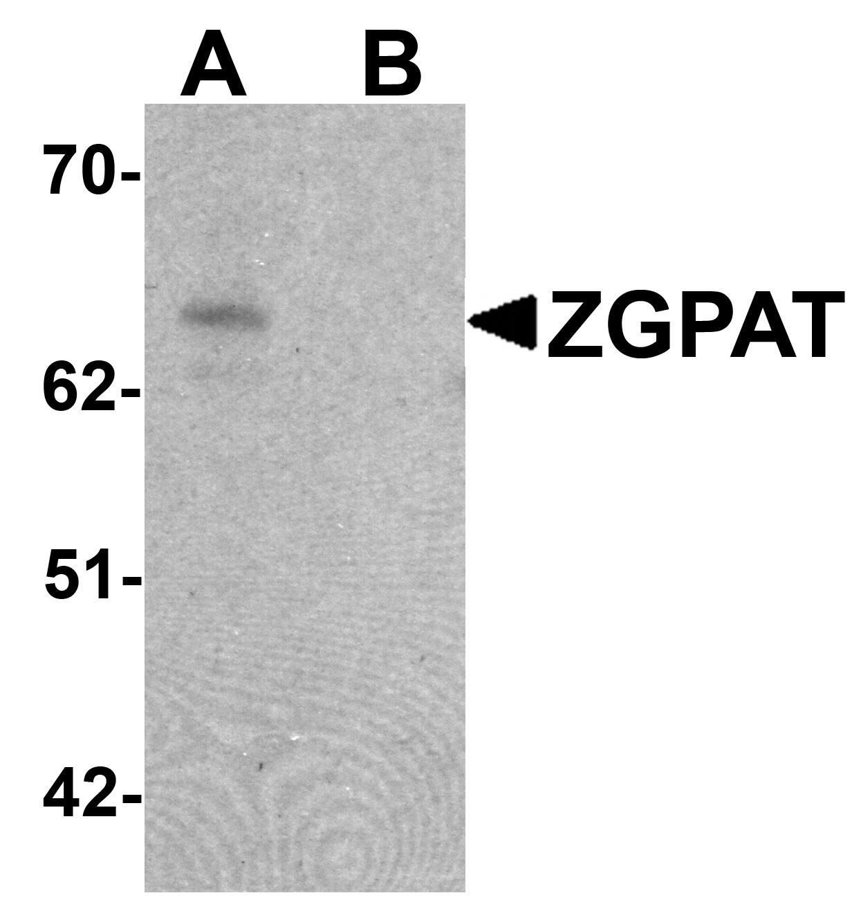 Western Blot: ZGPAT Antibody - BSA Free [NBP2-41146] - Western blot analysis of ZGPAT in SK-N-SH cell lysate with ZGPAT antibody at 1 u/mL in (A) the absence and (B) the presence of blocking peptide.