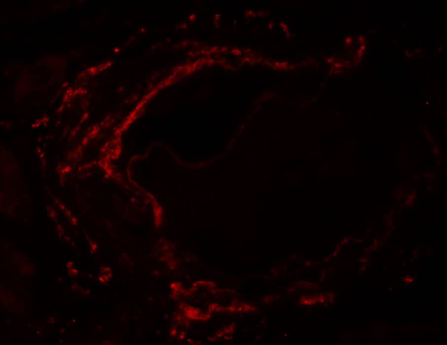 Immunocytochemistry/ Immunofluorescence LZTS2 Antibody - BSA Free