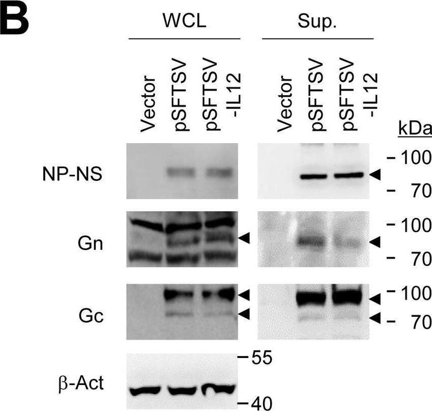 Characterization of gene expression after SFTSV DNA vaccine transfection.(A) Expression and secretion of the viral antigens and IL-12 in HEK293 cells transfected with the DNAs was confirmed by measuring the concentration of Flt3L and IL-12 in the cell culture supernatants by ELISA. Data are presented as mean + S.D. from triplicated experiments. (B) Expression of the viral antigens, Gn (~ 74 kDa), Gc (~ 71 kDa), and NP-NS fusion (~ 80 kDa) proteins, in cell lysates (left panels) and culture supernatants (right panels) of transfected HEK293 cells was assessed by immunoblot analysis using anti-Gn, Gc, or NP antibodies, respectively. The specific bands of antigens corresponding to their expected sizes are indicated with arrow heads.  beta -actin was used as loading control. Image collected and cropped by CiteAb from the following open publication (//pubmed.ncbi.nlm.nih.gov/32196487), licensed under a CC-BY license. Not internally tested by Novus Biologicals.