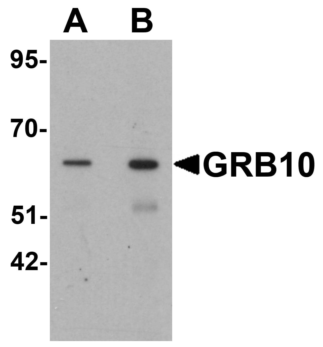 Western Blot: GRB10 Antibody - BSA Free [NBP2-41159] - Western blot analysis of GRB10 in SK-N-SH cell lysate with GRB10 antibody at (A) 1 and (B) 2 u/mL.