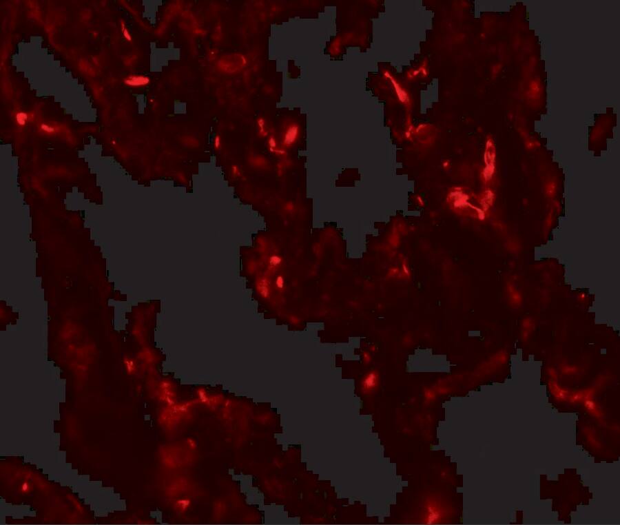 Immunocytochemistry/ Immunofluorescence: TTF-1 / NKX2-1 Antibody - BSA Free [NBP2-41160] - Immunofluorescence of TTF-1 / NKX2-1 in human lung tissue with TTF-1 / NKX2-1 antibody at 20 ug/mL.