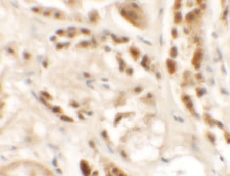 Immunohistochemistry: Siglec-15 Antibody - BSA Free [NBP2-41162] - Immunohistochemistry of Siglec-15 in human kidney tissue with Siglec-15 antibody at 2.5 ug/mL.